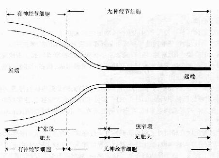 先天性巨结肠的发生示意图