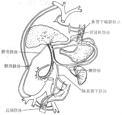 肝硬变时侧支循环模式图