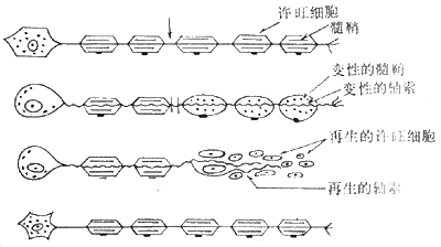 Waller变性模式图　（采自Escourolle）