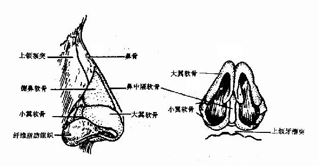 外鼻骨和软骨支架