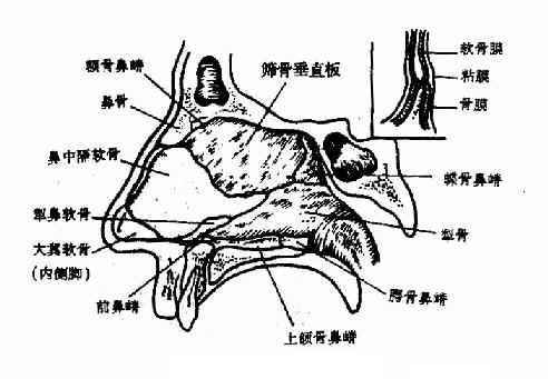 鼻中隔支架