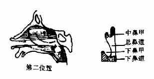 前鼻镜检查的三种位置