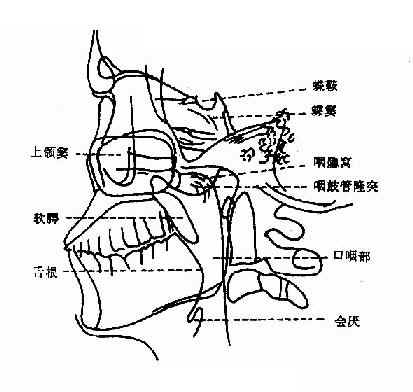 咽侧位