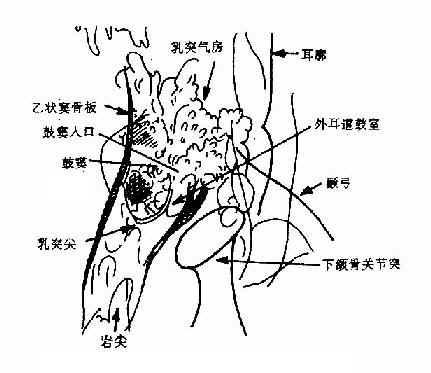 乳突Schueller 氏位