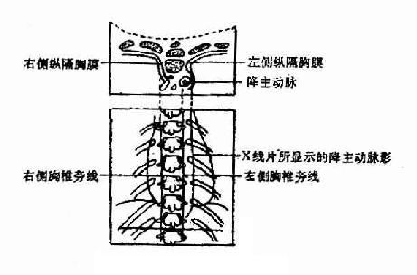 胸椎旁线