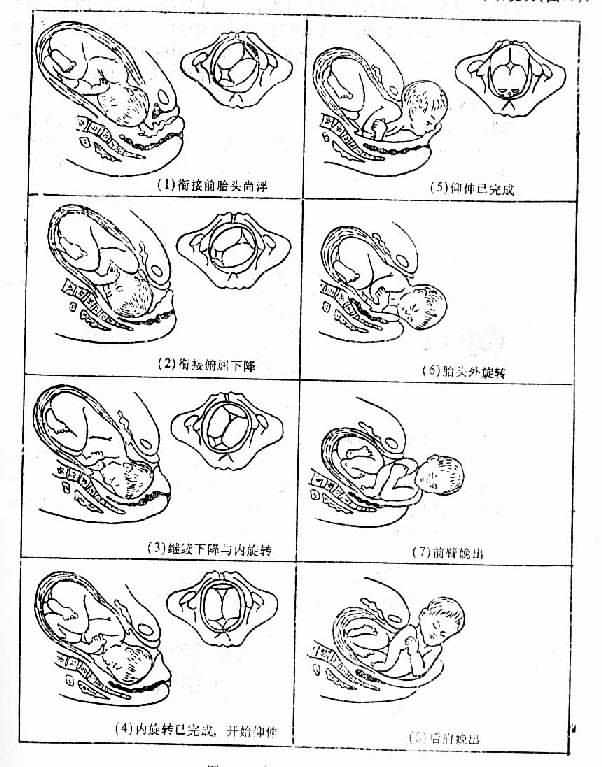 枕左前位分娩机转示意图