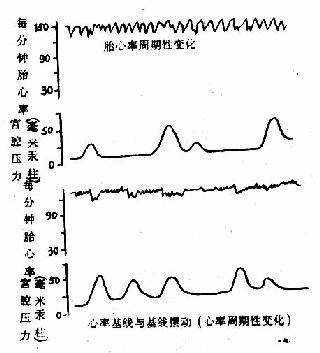 胎心率与基线摆动