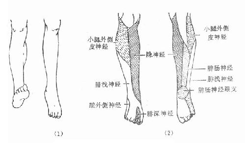 坐骨神经检查及其瘫痪表现