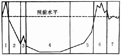 急性放射病外周血白细胞的阶段性变化