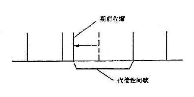 间歇脉