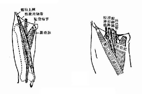 股静脉注射操作方法