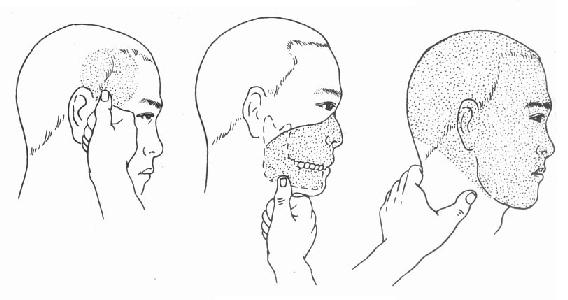 指压止血法