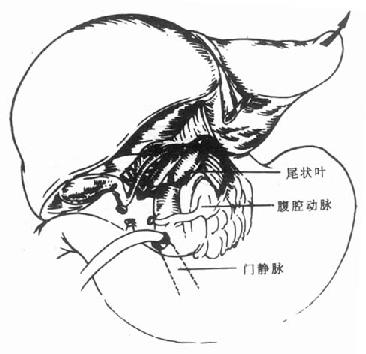 肝门横断后，将肝脏向上翻转，逐根结所肝短静脉