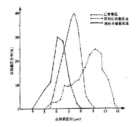 红细胞大小分布曲线