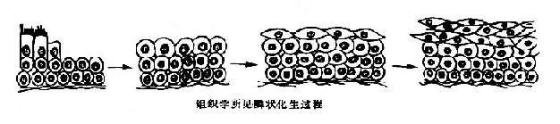 假复层纤毛柱状上皮鳞状化生过程示意图