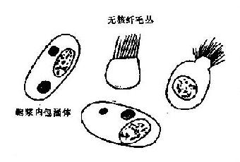 痰涂片内衰亡的纤毛柱状上皮细胞示意图