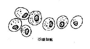 高分化腺癌细胞及其鉴别诊断