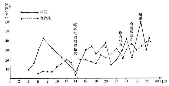 烧伤总面积86/Ⅲ°44%烧伤后每次手术及合并败血症时尿氮排出量的变化 