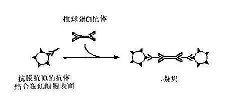 直接Coombs试验