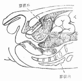 腹膜内、外破裂尿外渗范围