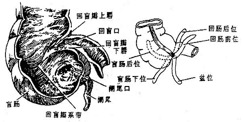 盲肠内腔及阑尾炎