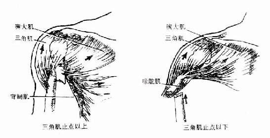 肱骨三角肌止点上、下骨折