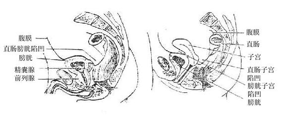 男女骨盆矢状切面（示腹膜与脏器关系）