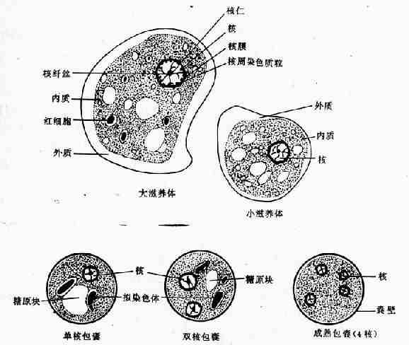 溶组织内阿米巴（铁苏木素染色）