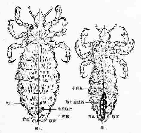 人虱成虫