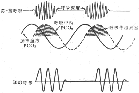 异常呼吸型式示意图