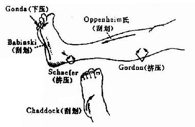 病理反射检查法