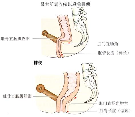 肛门直肠角