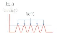 呼吸时胃内静息压变化，吸气时压力升高。