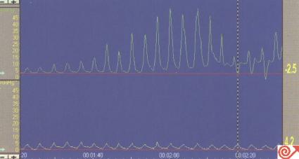 定点牵拉法通过LES