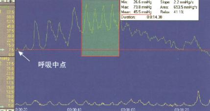 LES高压区平均压力