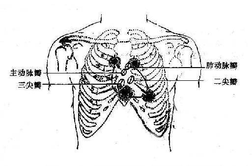 心脏各瓣膜在胸壁上的投影点及其听诊部位