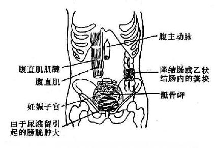 腹部触诊时容易被误为异常的正常情况示意图