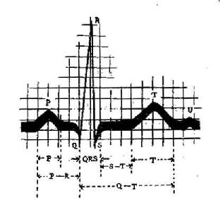 心电图各波和波段示意图