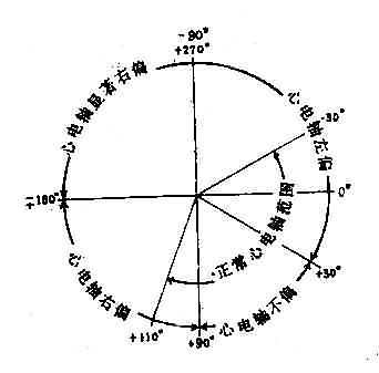 心电轴正常范围与偏移