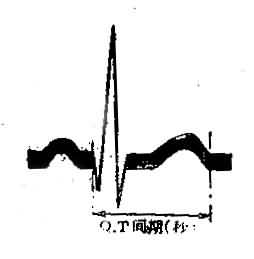 心电图各波及间期的测量方法