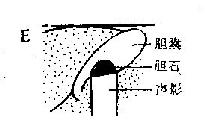 正常人体组织与病理组织反射规律