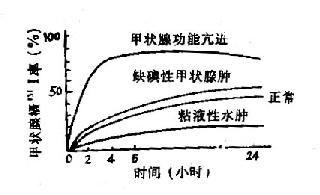 几种甲状腺疾病时甲状