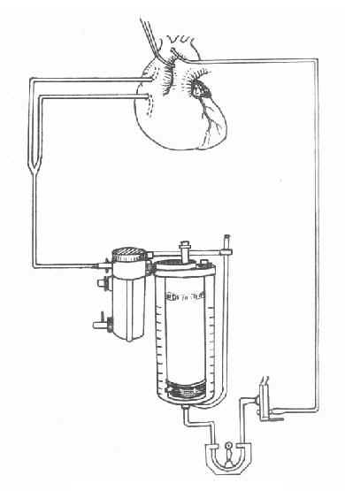 体外循环装置示意图