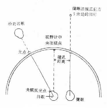 视野计测量斜视角法