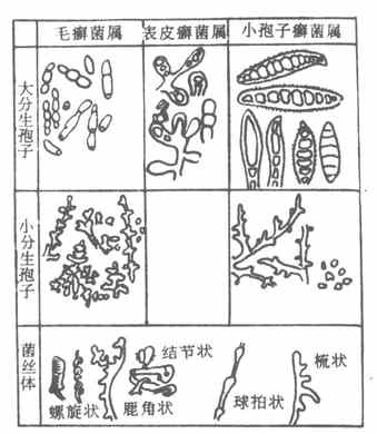 皮肤丝状菌的孢子及菌丝形态