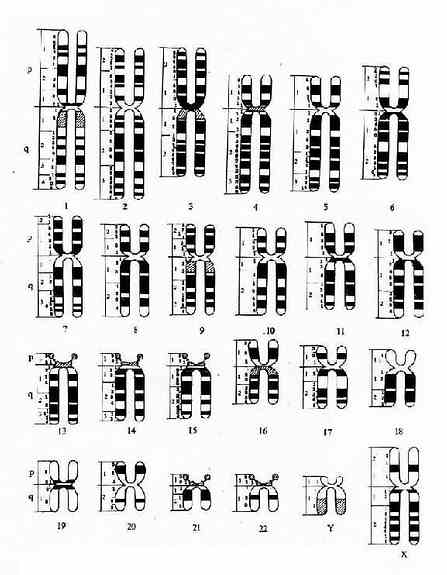 显带染色体模式图（巴黎会议，1971）