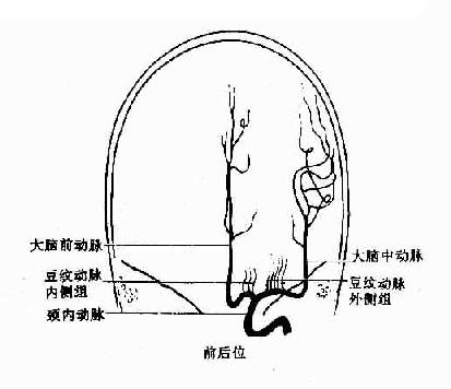 正常颈动脉造影