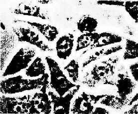 体外培养的上皮细胞在相差显微镜下的图像 