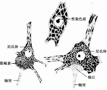  神经元胞体光镜结构，示尼氏体