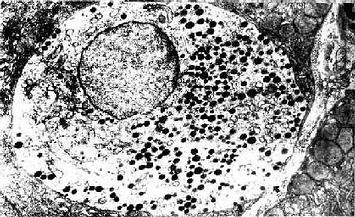  小鼠肠腺内的APUD细胞 